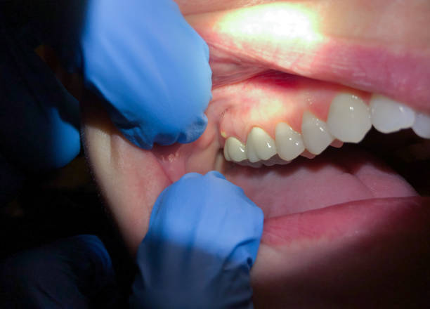Best Broken or Cracked Tooth Emergency Dentist in Munday, TX